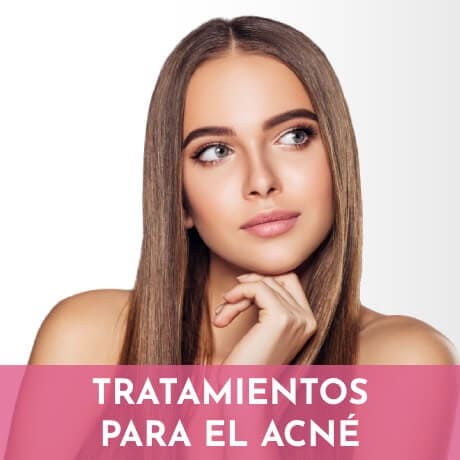 tratamientos-acne